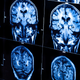 Illustration for article titled The Obama Administration's 10-Year Plan to Map the Entire Human Brain